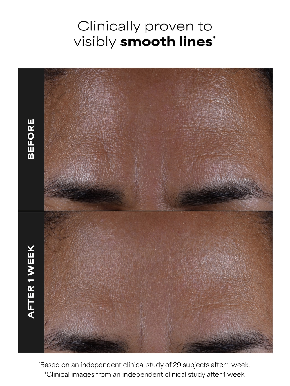 Paula’s Choice 2% BHA pore appearance results